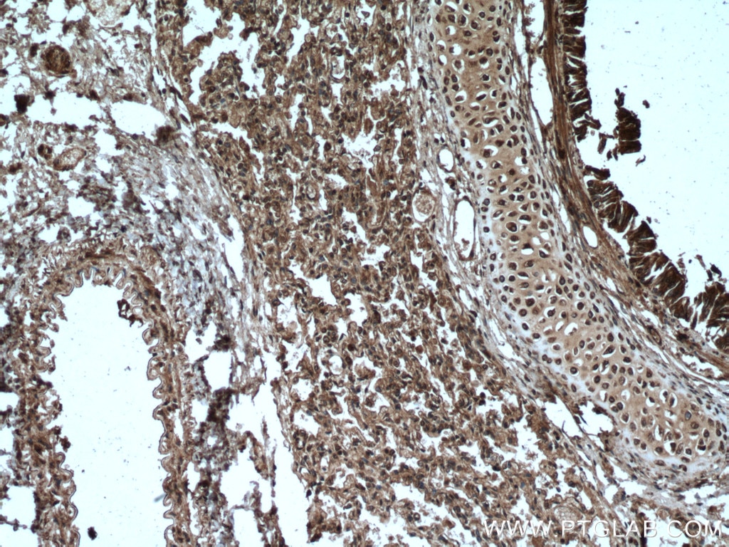 Immunohistochemistry (IHC) staining of human lung tissue using NOSIP Polyclonal antibody (27979-1-AP)