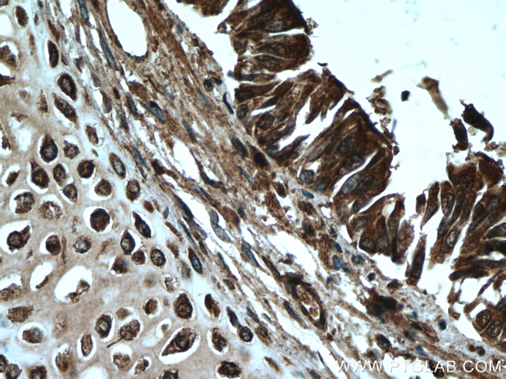 Immunohistochemistry (IHC) staining of human lung tissue using NOSIP Polyclonal antibody (27979-1-AP)