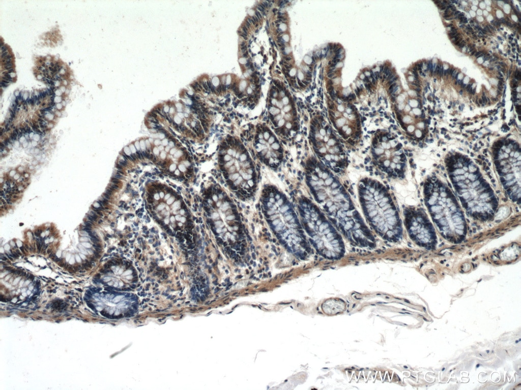 Immunohistochemistry (IHC) staining of human colon tissue using NOSIP Polyclonal antibody (27979-1-AP)