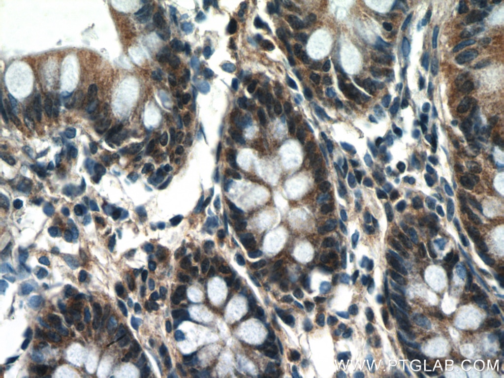 Immunohistochemistry (IHC) staining of human colon tissue using NOSIP Polyclonal antibody (27979-1-AP)