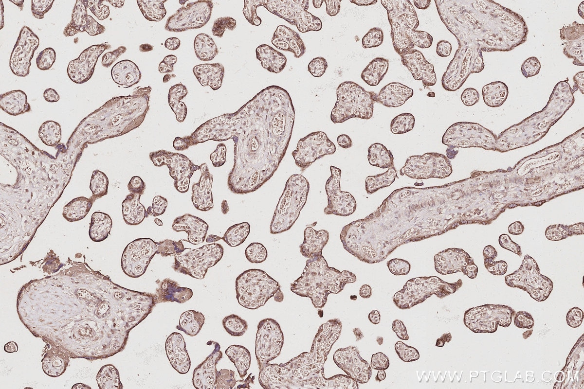 IHC staining of human placenta using 27979-1-AP Immunohistochemistry (IHC) staining of human placenta tissue using NOSIP Polyclonal antibody (27979-1-AP)