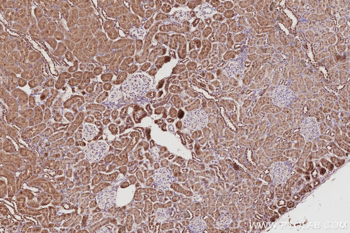 IHC staining of rat kidney using 27979-1-AP Immunohistochemistry (IHC) staining of rat kidney tissue using NOSIP Polyclonal antibody (27979-1-AP)