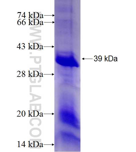 NOSIP fusion protein Ag27569 SDS-PAGE