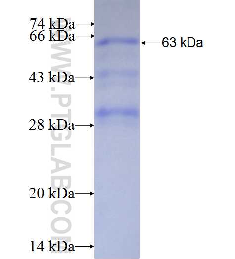 NOSIP fusion protein Ag1562 SDS-PAGE