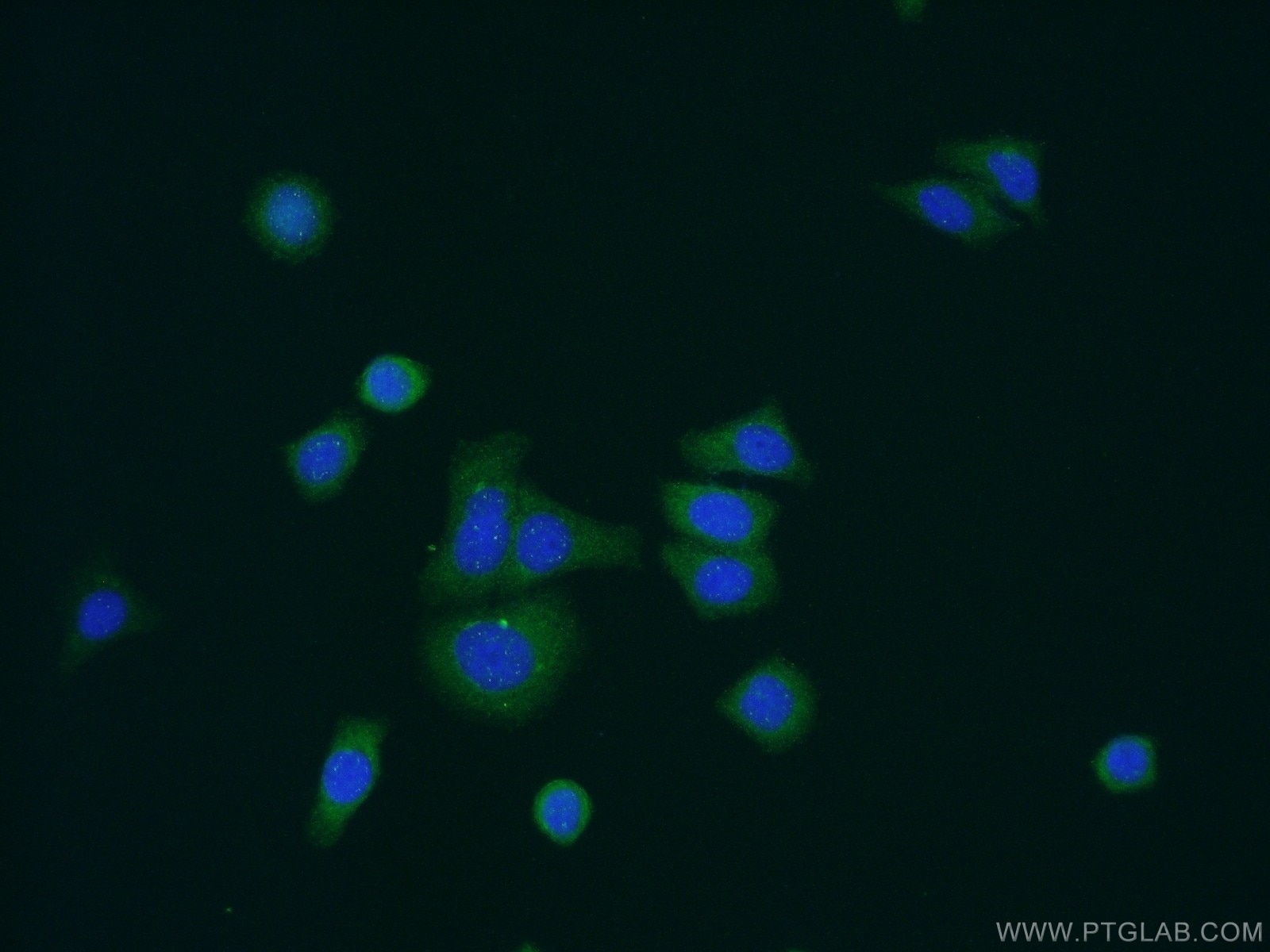 Immunofluorescence (IF) / fluorescent staining of HepG2 cells using NOSTRIN Polyclonal antibody (20116-1-AP)
