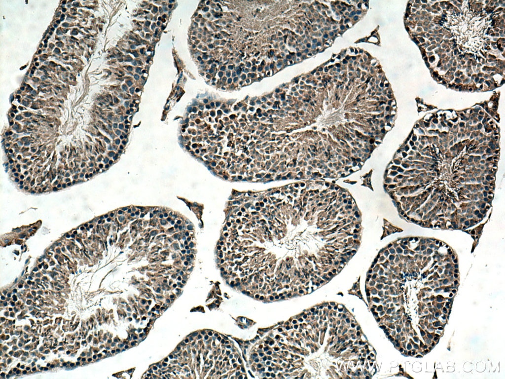 IHC staining of mouse testis using 20116-1-AP
