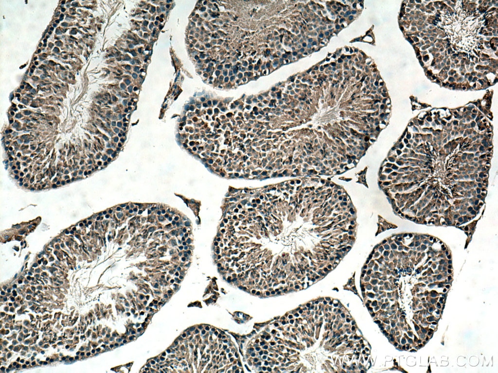 Immunohistochemistry (IHC) staining of mouse testis tissue using NOSTRIN Polyclonal antibody (20116-1-AP)