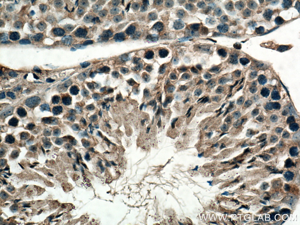 Immunohistochemistry (IHC) staining of mouse testis tissue using NOSTRIN Polyclonal antibody (20116-1-AP)