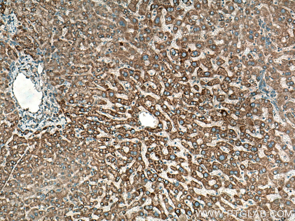 Immunohistochemistry (IHC) staining of human hepatocirrhosis tissue using NOSTRIN Polyclonal antibody (20116-1-AP)