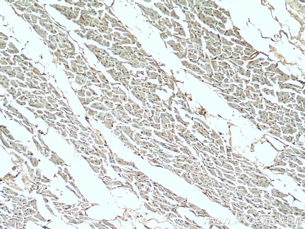 Immunohistochemistry (IHC) staining of human heart tissue using NOSTRIN Polyclonal antibody (20116-1-AP)