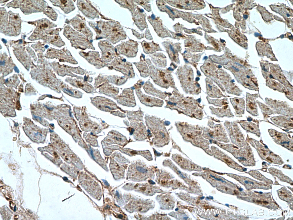 Immunohistochemistry (IHC) staining of human heart tissue using NOSTRIN Polyclonal antibody (20116-1-AP)