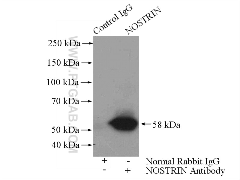 Immunoprecipitation (IP) experiment of human placenta tissue using NOSTRIN Polyclonal antibody (20116-1-AP)