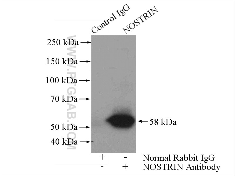 IP experiment of human placenta using 20116-1-AP