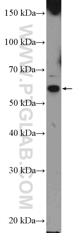 Western Blot (WB) analysis of K-562 cells using NOSTRIN Polyclonal antibody (20116-1-AP)