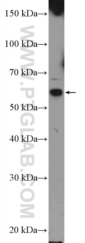 WB analysis of K-562 using 20116-1-AP