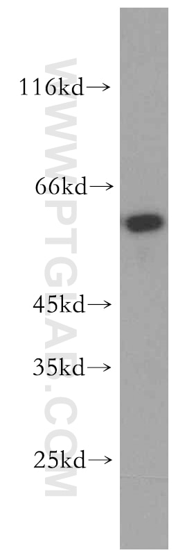 Western Blot (WB) analysis of human placenta tissue using NOSTRIN Polyclonal antibody (20116-1-AP)