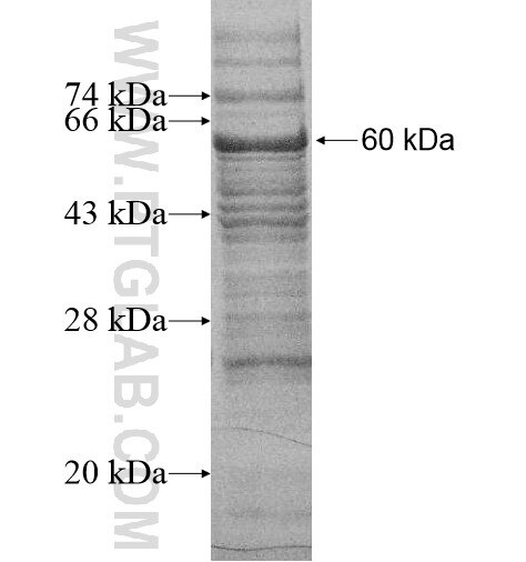 NOSTRIN fusion protein Ag13989 SDS-PAGE