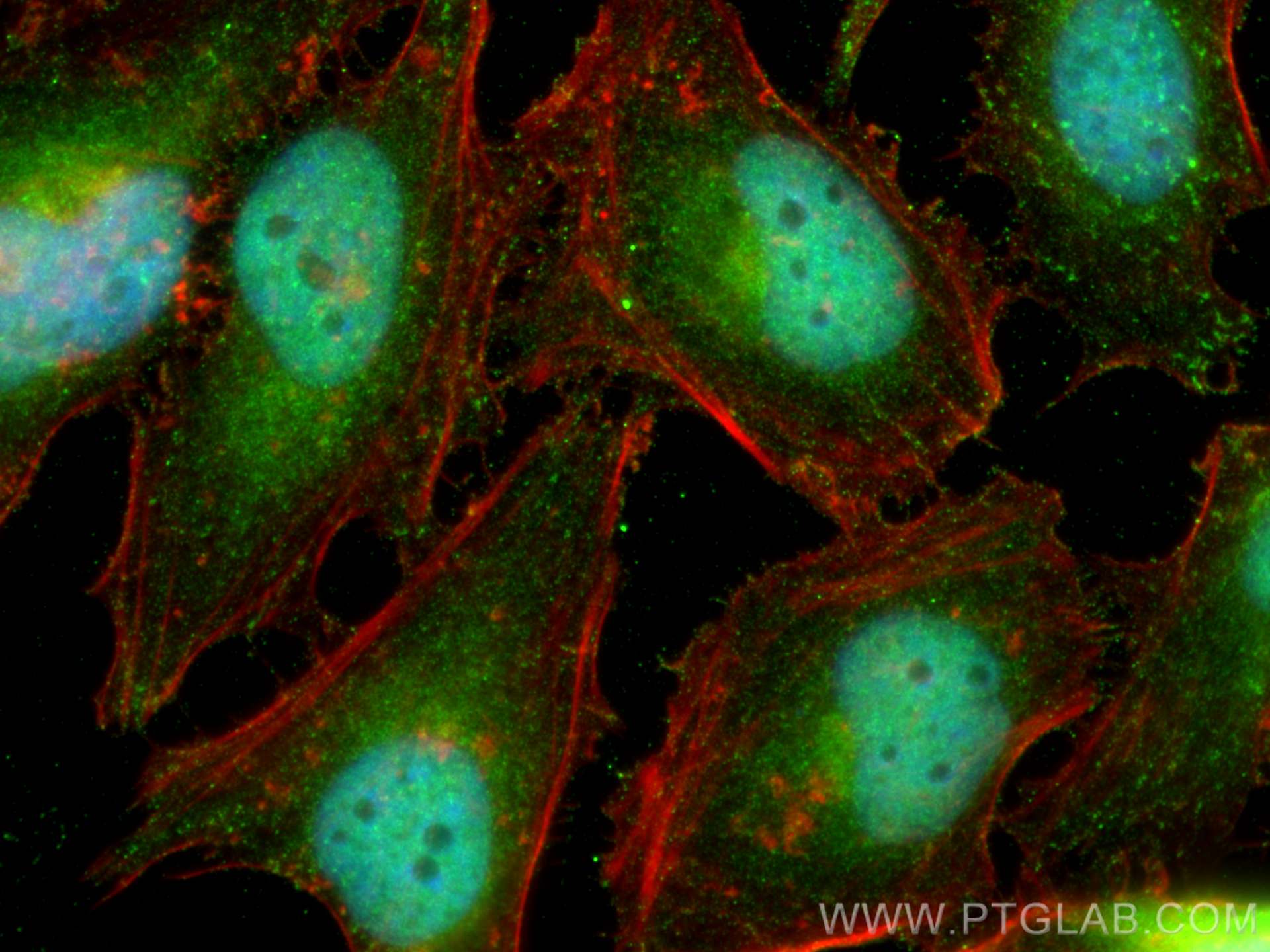 Immunofluorescence (IF) / fluorescent staining of HeLa cells using NOTCH1 Polyclonal antibody (20687-1-AP)