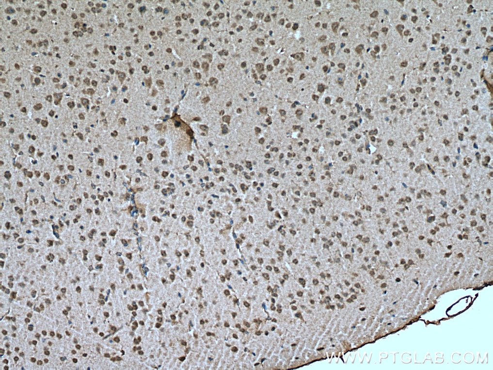 Immunohistochemistry (IHC) staining of mouse brain tissue using NOTCH1 Polyclonal antibody (20687-1-AP)