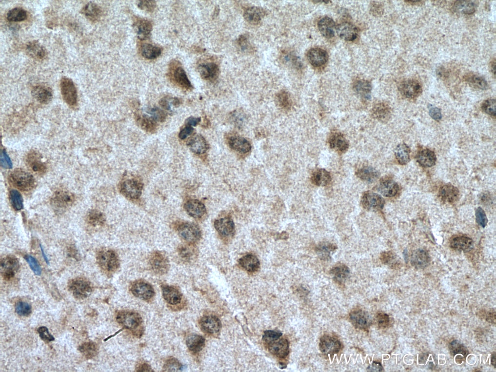 Immunohistochemistry (IHC) staining of mouse brain tissue using NOTCH1 Polyclonal antibody (20687-1-AP)