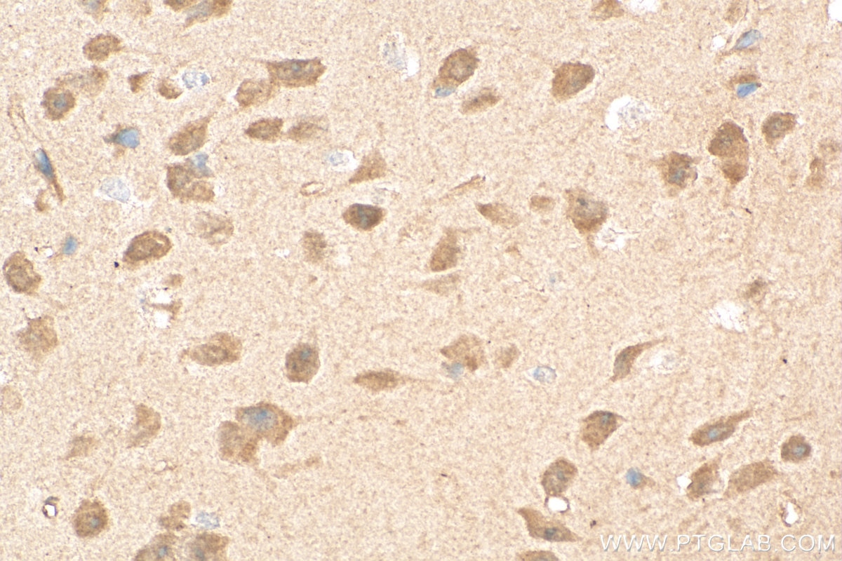 Immunohistochemistry (IHC) staining of mouse brain tissue using NOTCH1 Polyclonal antibody (20687-1-AP)