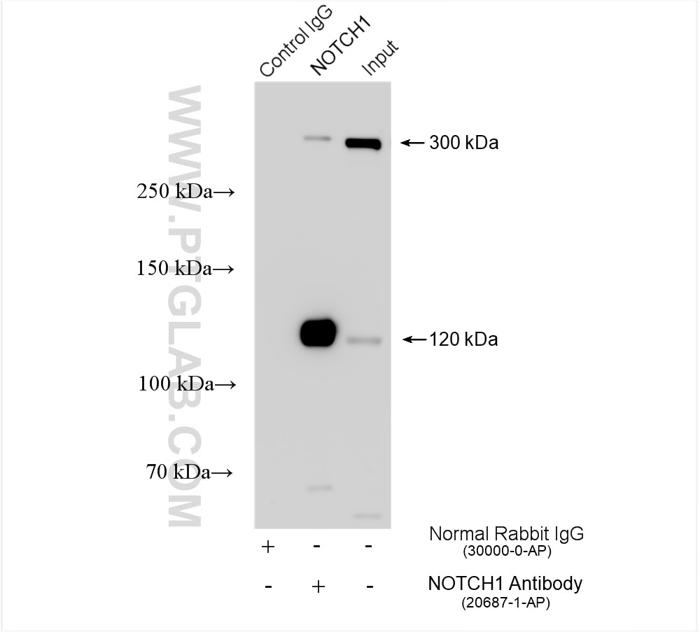 Immunoprecipitation (IP) experiment of HEK-293 cells using NOTCH1 Polyclonal antibody (20687-1-AP)