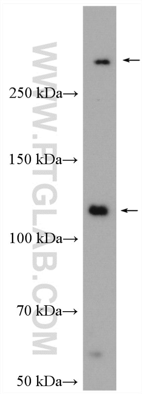 Western Blot (WB) analysis of HEK-293 cells using NOTCH1 Polyclonal antibody (20687-1-AP)