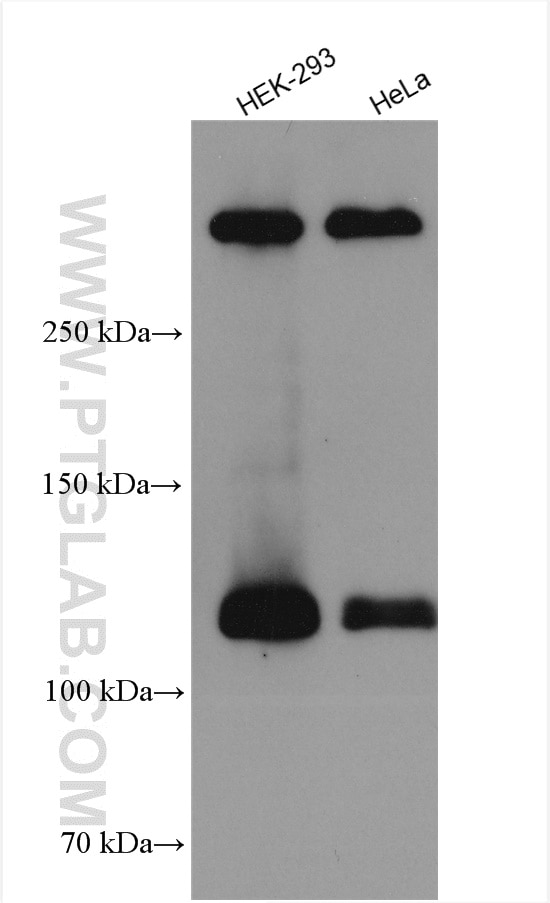 Western Blot (WB) analysis of HEK-293 cells using NOTCH1 Polyclonal antibody (20687-1-AP)