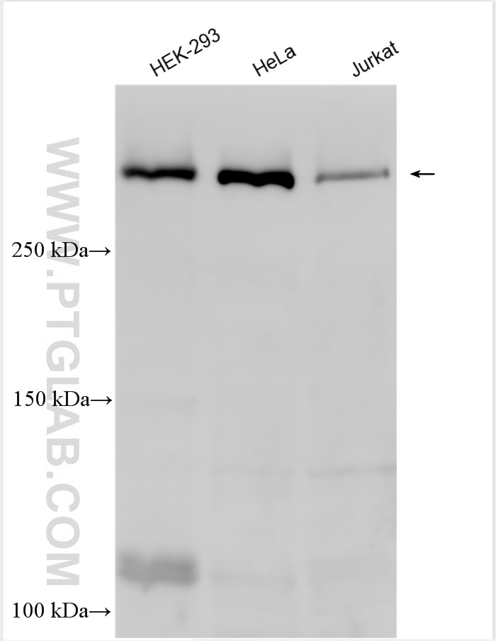 Western Blot (WB) analysis of various lysates using NOTCH1 Polyclonal antibody (20687-1-AP)