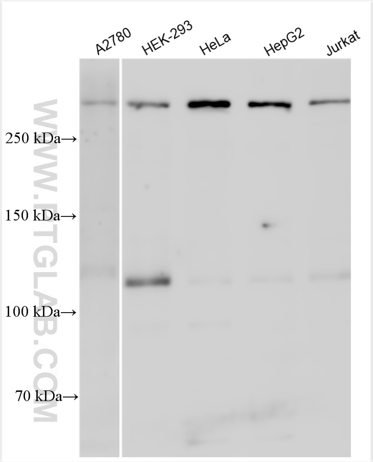 Western Blot (WB) analysis of various lysates using NOTCH1 Polyclonal antibody (20687-1-AP)