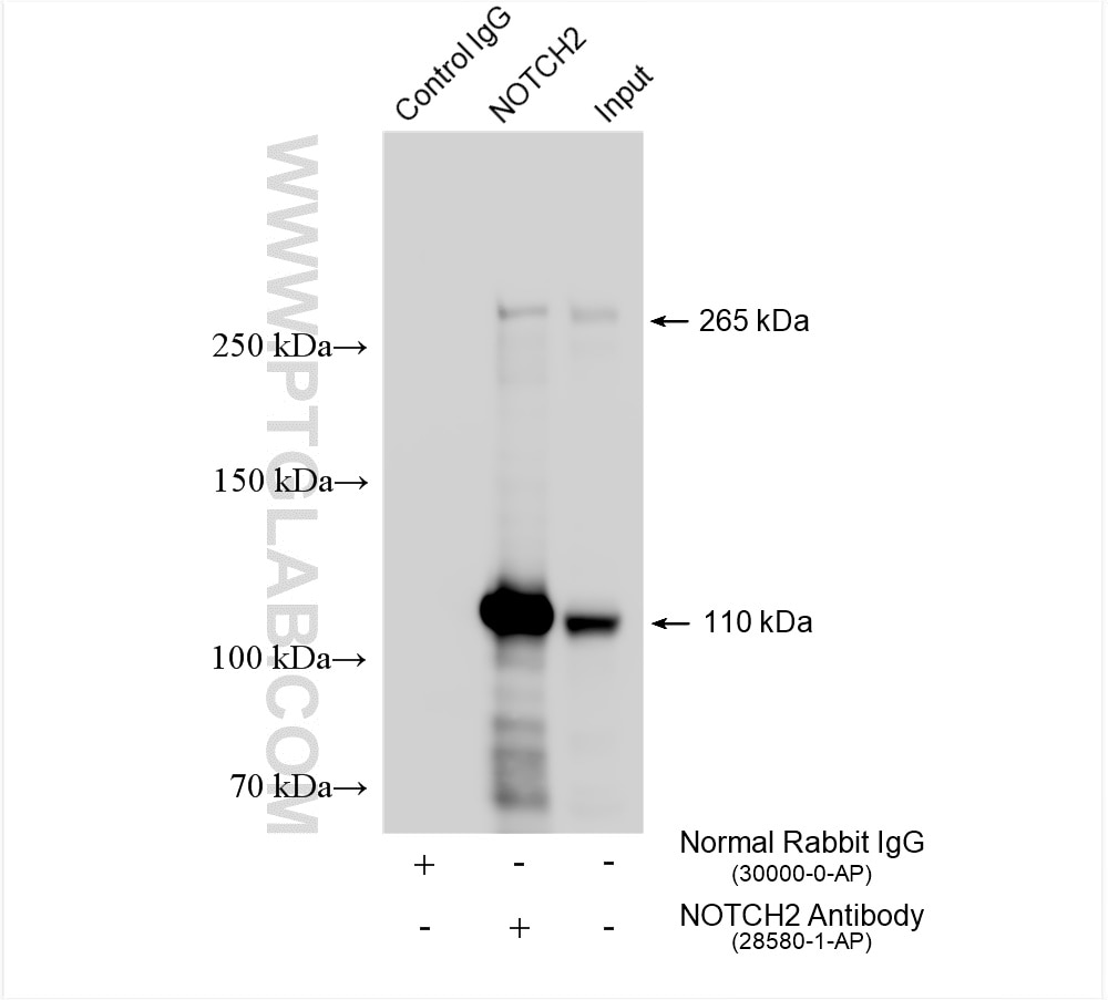 Immunoprecipitation (IP) experiment of U-87 MG cells using NOTCH2 Polyclonal antibody (28580-1-AP)