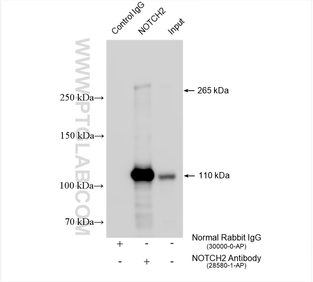 Immunoprecipitation (IP) experiment of HEK-293 cells using NOTCH2 Polyclonal antibody (28580-1-AP)