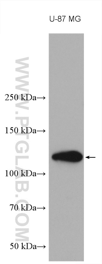Western Blot (WB) analysis of various lysates using NOTCH2 Polyclonal antibody (28580-1-AP)