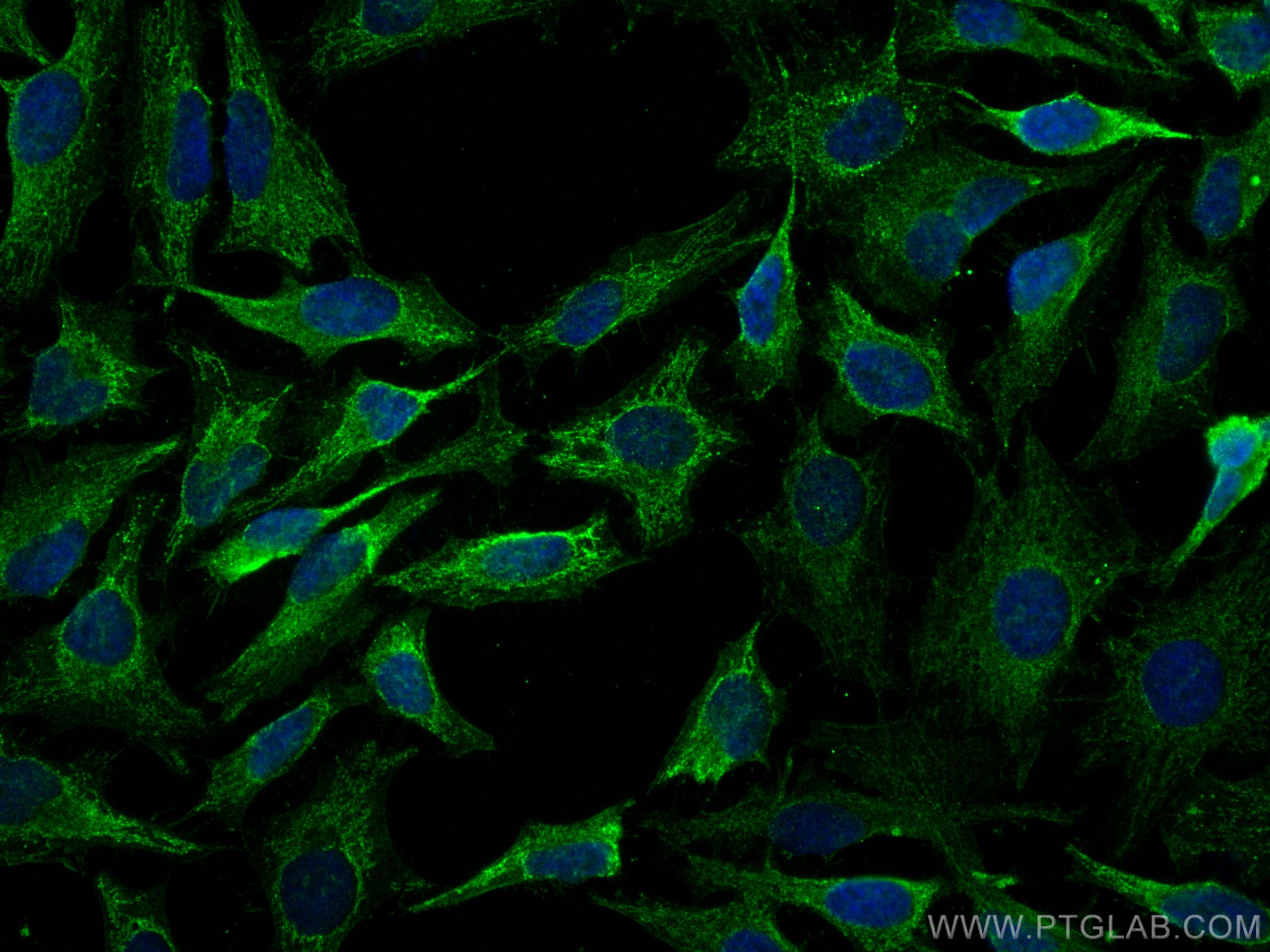 Immunofluorescence (IF) / fluorescent staining of HeLa cells using NOTCH2/NOTCH2NL Monoclonal antibody (68212-1-Ig)