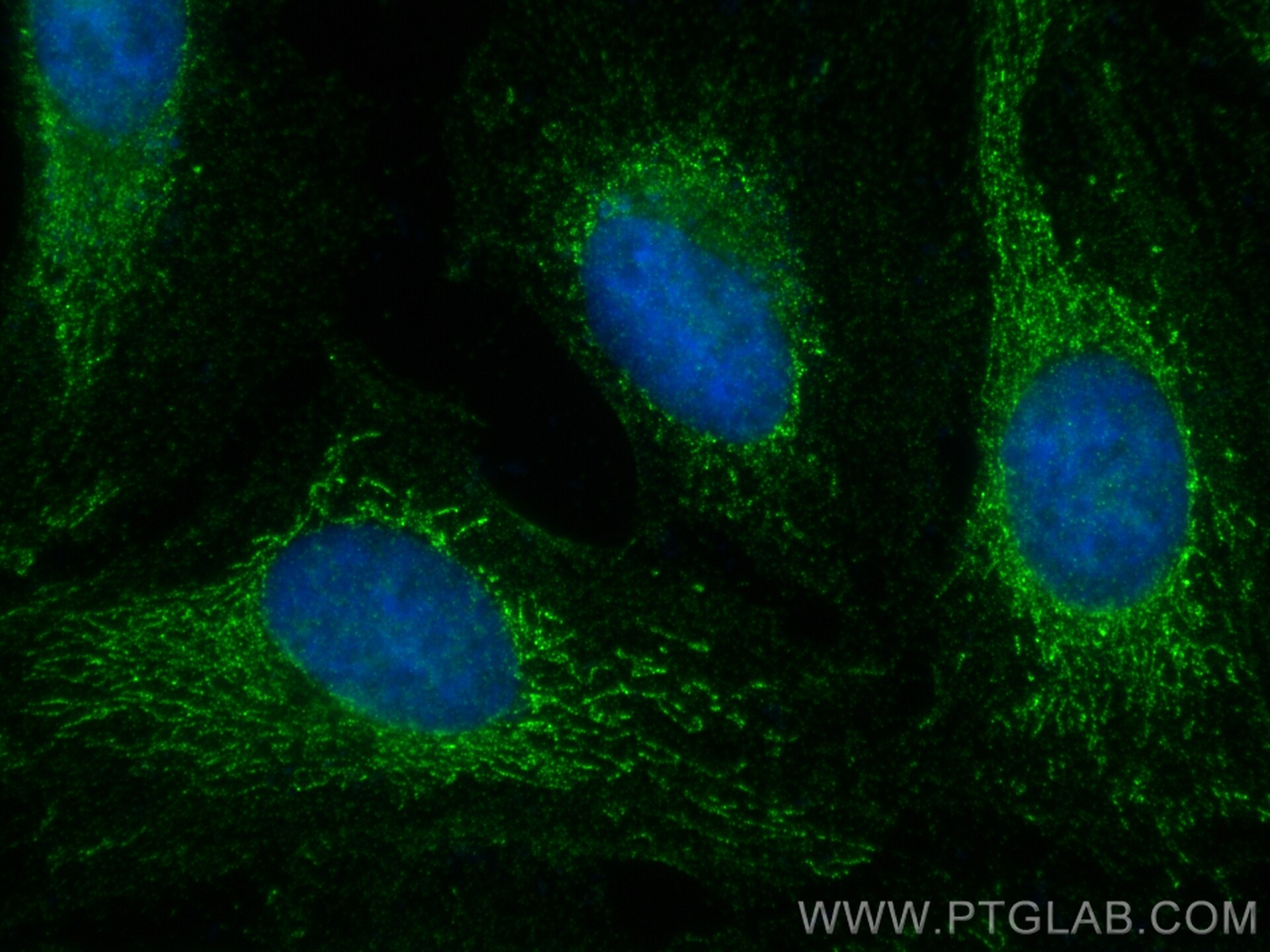 Immunofluorescence (IF) / fluorescent staining of HeLa cells using NOTCH2/NOTCH2NL Monoclonal antibody (68212-1-Ig)