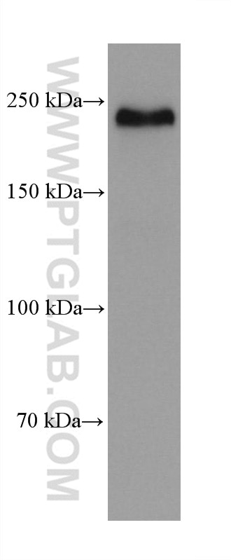 Western Blot (WB) analysis of hTERT-RPE1 cells using NOTCH2/NOTCH2NL Monoclonal antibody (68212-1-Ig)