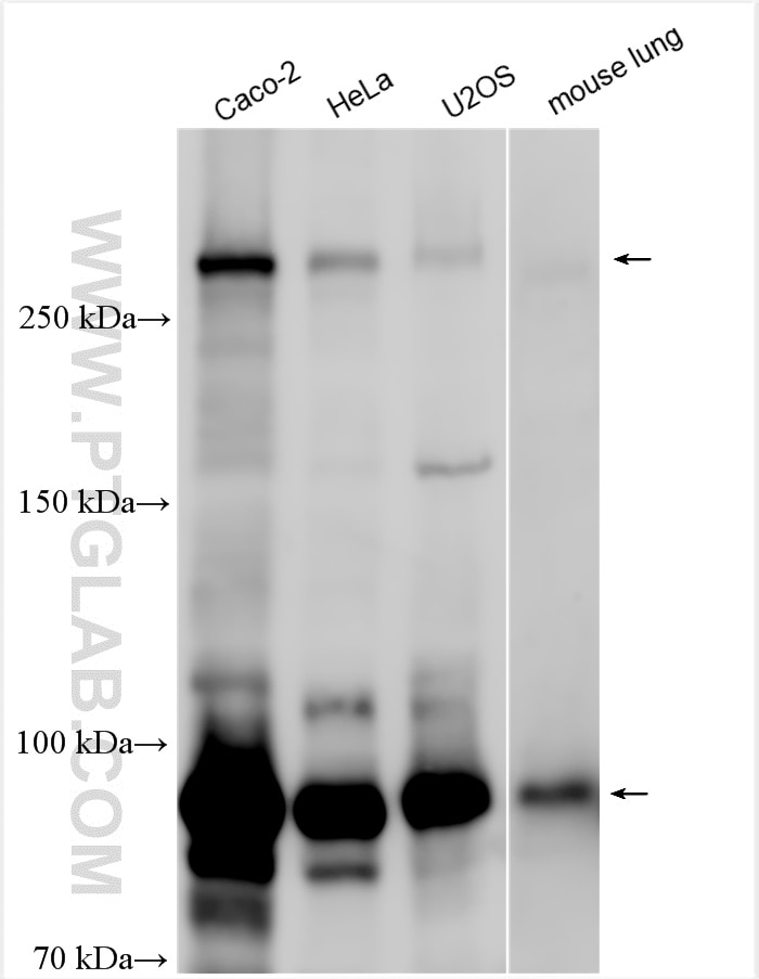 Western Blot (WB) analysis of various lysates using NOTCH3 Polyclonal antibody (30540-1-AP)