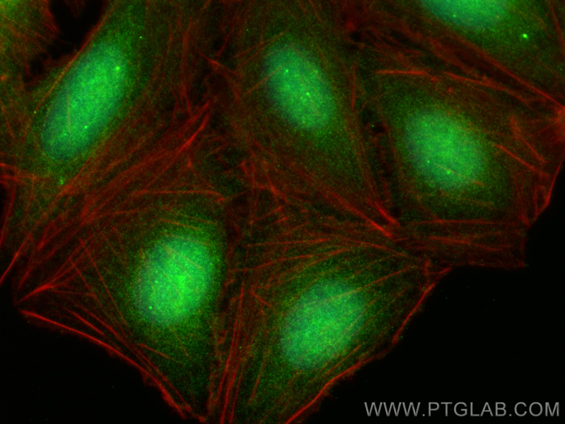 Immunofluorescence (IF) / fluorescent staining of U2OS cells using NOTCH3 Polyclonal antibody (55114-1-AP)