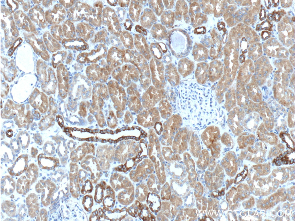 Immunohistochemistry (IHC) staining of human kidney tissue using NOTCH3 Polyclonal antibody (55114-1-AP)