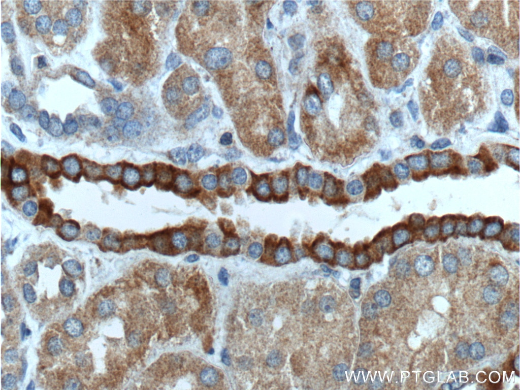 Immunohistochemistry (IHC) staining of human kidney tissue using NOTCH3 Polyclonal antibody (55114-1-AP)