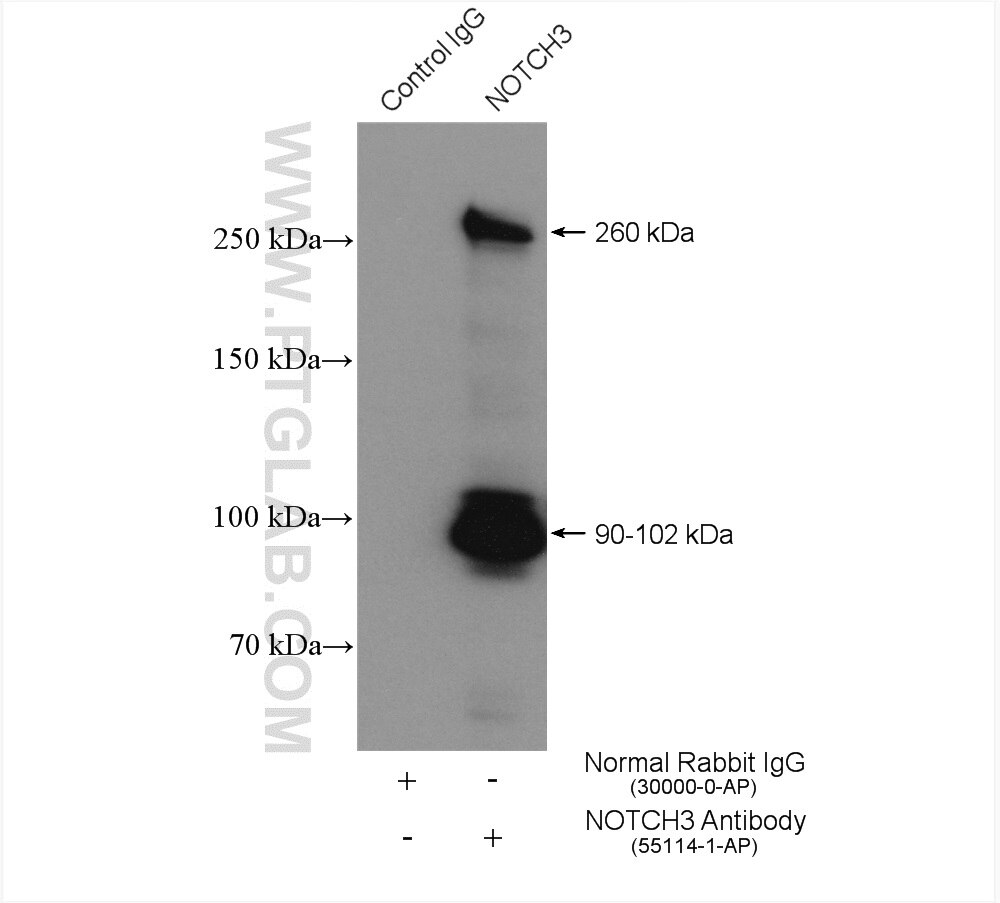 Immunoprecipitation (IP) experiment of HeLa cells using NOTCH3 Polyclonal antibody (55114-1-AP)