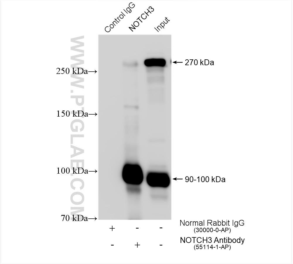 IP experiment of HeLa using 55114-1-AP