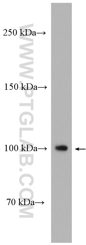 Western Blot (WB) analysis of U2OS cells using NOTCH3 Polyclonal antibody (55114-1-AP)