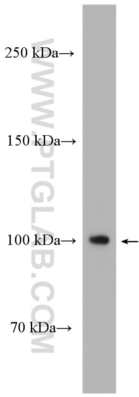 WB analysis of U2OS using 55114-1-AP