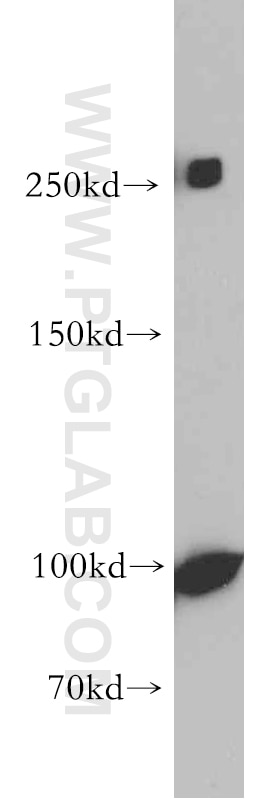 WB analysis of COLO 320 using 55114-1-AP