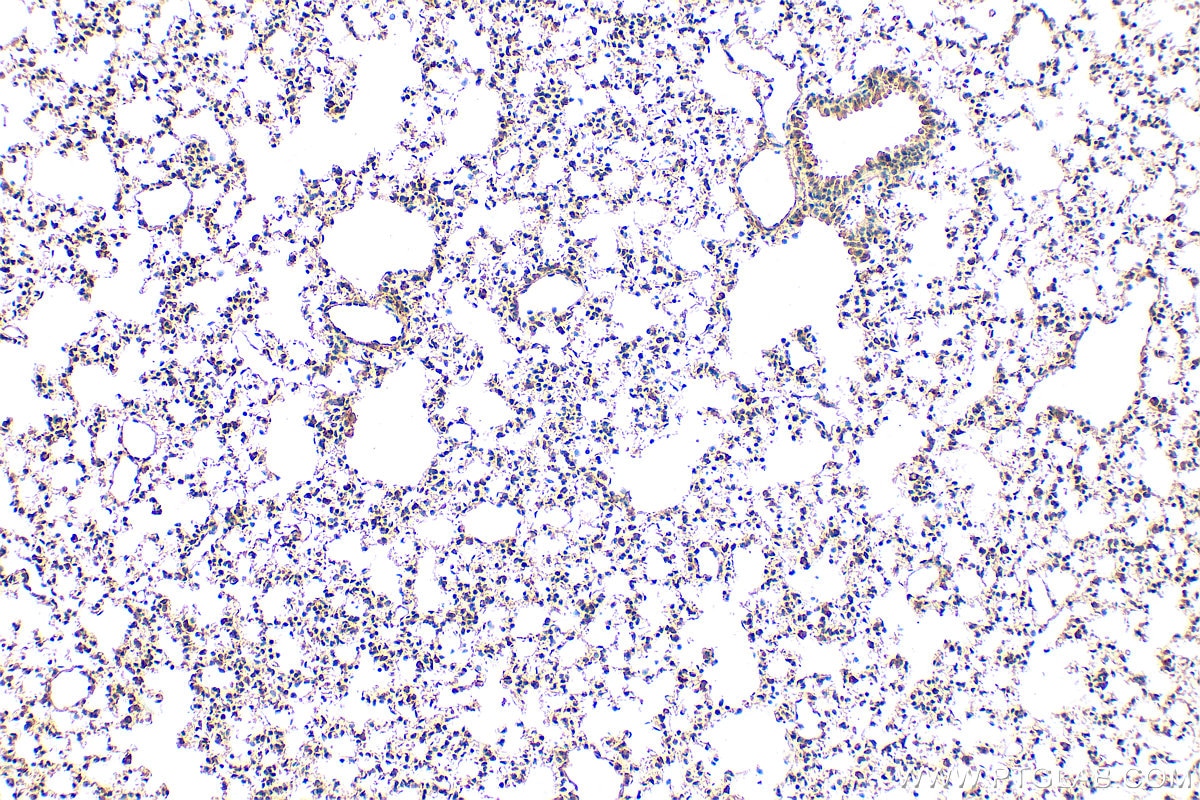 Immunohistochemical analysis of paraffin-embedded mouse lung tissue slide using 33280-1-AP (NOTCH4 antibody) at dilution of 1:200 (under 10x lens). Heat mediated antigen retrieval with Tris-EDTA buffer (pH 9.0). Immunohistochemistry (IHC) staining of mouse lung tissue using NOTCH4 Polyclonal antibody (33280-1-AP)