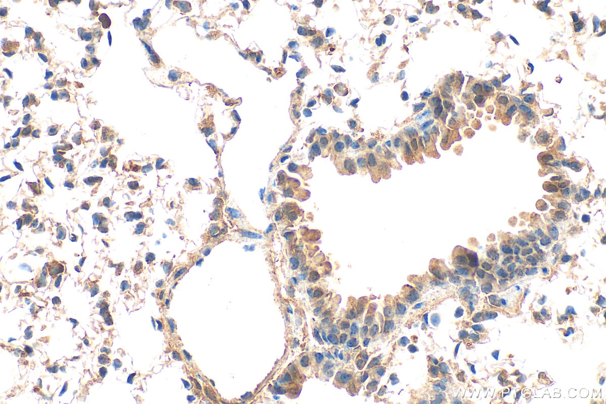 Immunohistochemical analysis of paraffin-embedded mouse lung tissue slide using 33280-1-AP (NOTCH4 antibody) at dilution of 1:200 (under 40x lens). Heat mediated antigen retrieval with Tris-EDTA buffer (pH 9.0). Immunohistochemistry (IHC) staining of mouse lung tissue using NOTCH4 Polyclonal antibody (33280-1-AP)