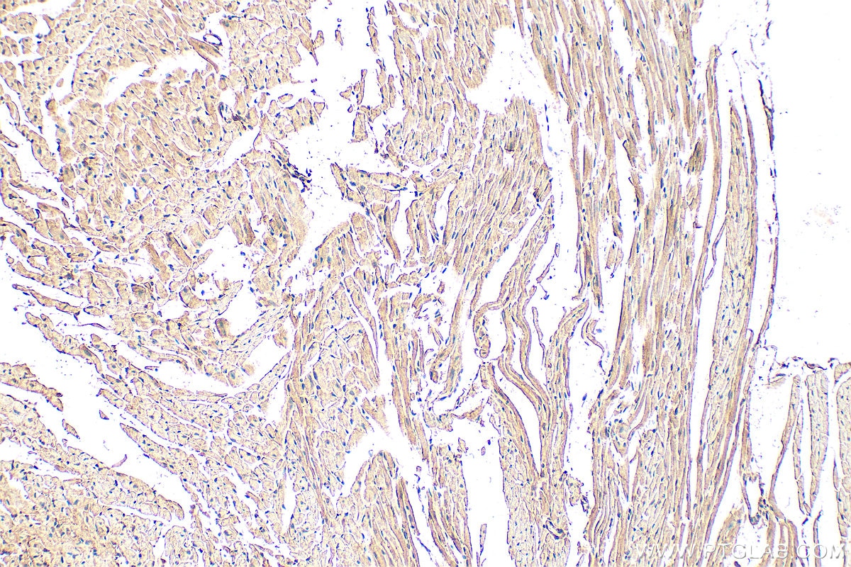 Immunohistochemical analysis of paraffin-embedded mouse heart tissue slide using 33280-1-AP (NOTCH4 antibody) at dilution of 1:200 (under 10x lens). Heat mediated antigen retrieval with Tris-EDTA buffer (pH 9.0). Immunohistochemistry (IHC) staining of mouse heart tissue using NOTCH4 Polyclonal antibody (33280-1-AP)