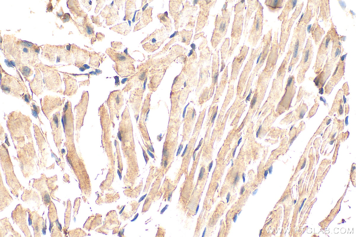 Immunohistochemical analysis of paraffin-embedded mouse heart tissue slide using 33280-1-AP (NOTCH4 antibody) at dilution of 1:200 (under 40x lens). Heat mediated antigen retrieval with Tris-EDTA buffer (pH 9.0). Immunohistochemistry (IHC) staining of mouse heart tissue using NOTCH4 Polyclonal antibody (33280-1-AP)