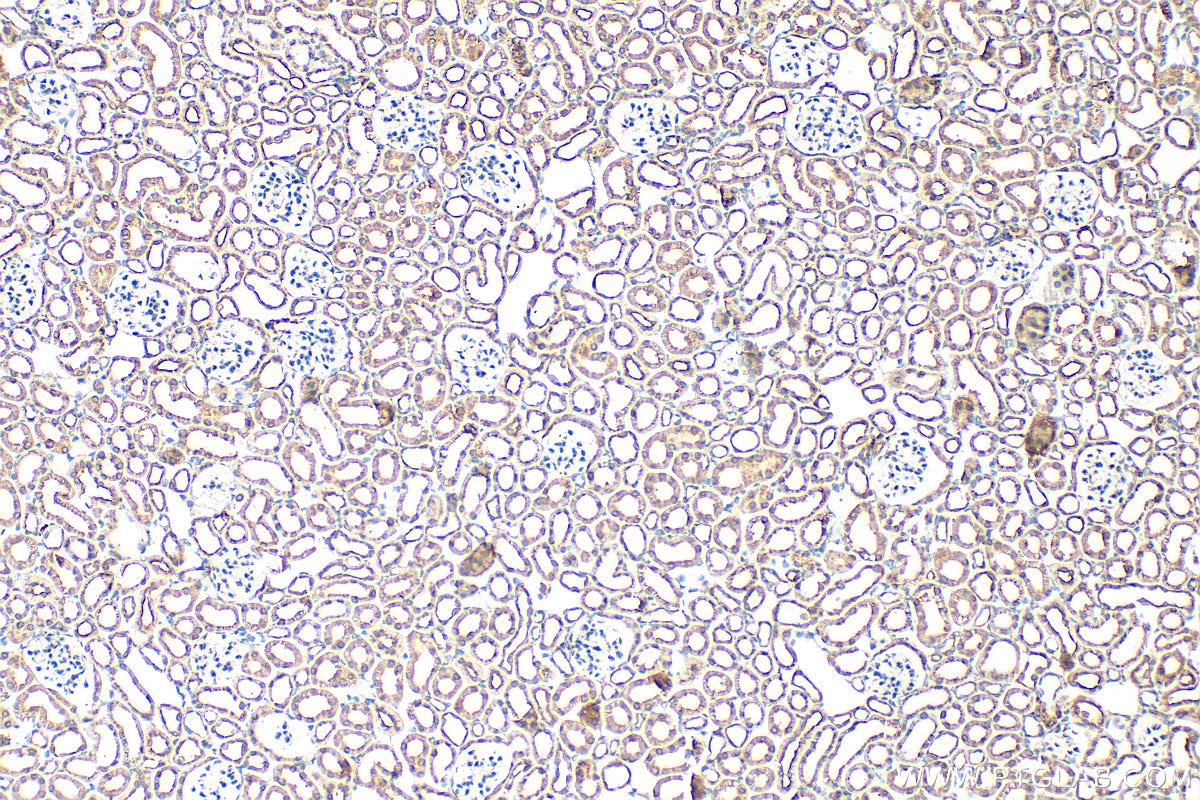 Immunohistochemical analysis of paraffin-embedded mouse kidney tissue slide using 33280-1-AP (NOTCH4 antibody) at dilution of 1:200 (under 10x lens). Heat mediated antigen retrieval with Tris-EDTA buffer (pH 9.0). Immunohistochemistry (IHC) staining of mouse kidney tissue using NOTCH4 Polyclonal antibody (33280-1-AP)